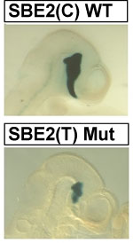 Comparison of expression of a reporter gene under the regulatory control of a wild type and mutant Shh brain enhancer - SBE2 (blue). Top: wild type. Bottom: mutant Shh brain enhancer.